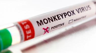 La OMS confirmó más de 5.000 casos de viruela del mono en el mundo