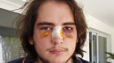 Imputaron a dos rugbiers por la golpiza a un adolescente de 18 años