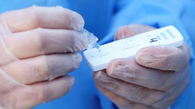 La Anmat aprobó un test rápido de coronavirus que ya se vende en farmacias